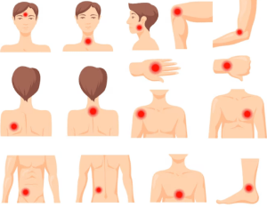 CBD Oil and Inflammation